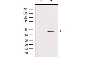 Western blot analysis of extracts from hybridoma cells, using HOXB3 Antibody. (HOXB3 antibody  (C-Term))