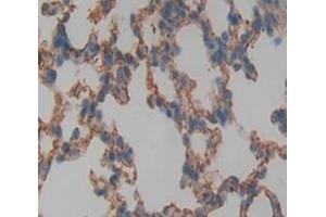 #VALUE! (GJA4 antibody  (AA 19-245))