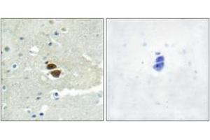 Immunohistochemistry analysis of paraffin-embedded human brain, using n-NOS (Phospho-Ser852) Antibody. (NOS1 antibody  (pSer852))