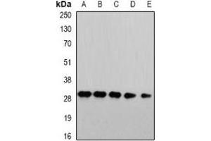 Western blot analysis of PSMA4 expression in HepG2 (A), Jurkat (B), mouse liver (C), COS7 (D), PC12 (E) whole cell lysates. (PSMA4 antibody)