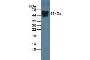 Western Blot; Sample: Rat Serum. (Vitamin D-Binding Protein antibody  (AA 209-394))