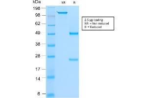 SDS-PAGE Analysis Purified MyoD1 Mouse Recombinant Monoclonal Antibody (rMYD712). (Recombinant MYOD1 antibody)