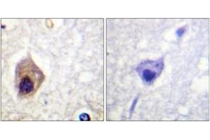 Immunohistochemistry analysis of paraffin-embedded human brain tissue, using Caspase 1 (Ab-376) Antibody.
