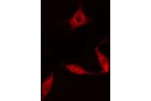 ABIN6278006 staining  HuvEc cells by IF/ICC. (DAPK3 antibody  (Internal Region))