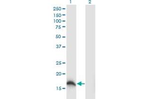 Western Blot analysis of SOD1 expression in transfected 293T cell line by SOD1 monoclonal antibody (M04), clone 10D5. (SOD1 antibody  (AA 1-154))