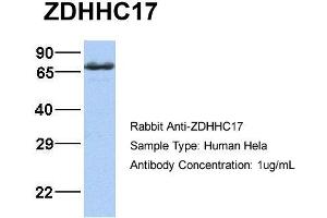 Host:  Rabbit  Target Name:  ZDHHC17  Sample Type:  Hela  Antibody Dilution:  1. (ZDHHC17 antibody  (Middle Region))