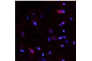 Netrin 4 antibody  (N-Term)