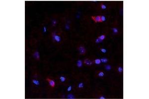 rat and mouse brain (Netrin 4 antibody  (N-Term))