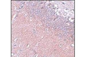 Immunohistochemistry of SYNGR4 in rat brain tissue with this product at 5 μg/ml (SYNGR4 antibody  (N-Term))