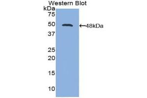 Western blot analysis of the recombinant protein. (IL-21 antibody  (AA 23-155))