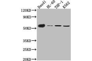 Western Blot Positive WB detected in: Daudi whole cell lysate, HL-60 whole cell lysate, THP-1 cell lysate, K562 cell lysate All lanes: CD27 antibody at 1:1000 Secondary Goat polyclonal to rabbit IgG at 1/50000 dilution Predicted band size: 30 kDa Observed band size: 55 kDa (Recombinant CD27 antibody)