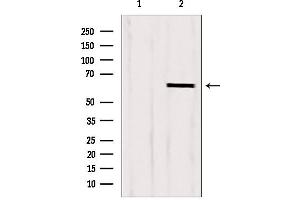 Western blot analysis of extracts from HepG2, using CKAP4 antibody. (CKAP4 antibody  (C-Term))