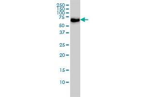 CARF monoclonal antibody (M02), clone 1A6 Western Blot analysis of CARF expression in Hela S3 NE . (CDKN2AIP antibody  (AA 1-579))