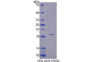 SDS-PAGE analysis of Human INPP4A Protein.