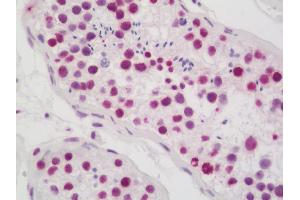 Anti-CASP1 / Caspase 1 antibody IHC staining of human testis. (Caspase 1 antibody  (AA 120-269) (FITC))