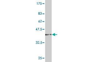 Western Blot detection against Immunogen (37. (CAMK2D antibody  (AA 301-410))