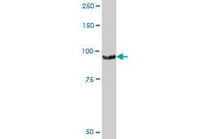 DAB2 MaxPab polyclonal antibody. (DAB2 antibody  (AA 1-770))