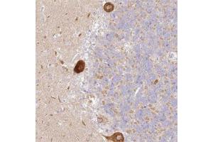 Immunohistochemical staining of human cerebellum with LRRC15 polyclonal antibody  shows strong cytoplasmic positivity in Purkinje cells at 1:20-1:50 dilution. (LRRC15 antibody)