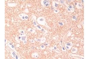 Detection of DSC1 in Human Cerebrum Tissue using Polyclonal Antibody to Desmocollin 1 (DSC1) (Desmocollin 1 antibody  (AA 486-686))