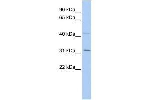 Western Blotting (WB) image for anti-SIX Homeobox 1 (SIX1) antibody (ABIN2457949) (SIX Homeobox 1 antibody)