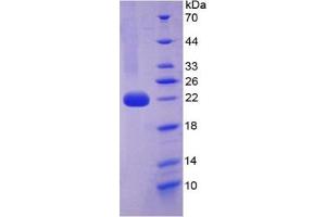 SDS-PAGE of Protein Standard from the Kit  (Highly purified E.