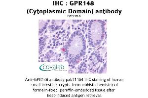 Image no. 1 for anti-G Protein-Coupled Receptor 148 (GPR148) (3rd Cytoplasmic Domain) antibody (ABIN1734951) (GPR148 antibody  (3rd Cytoplasmic Domain))