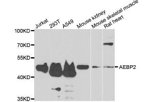 Western blot analysis of extracts of various cell lines, using AEBP2 antibody. (AEBP2 antibody)