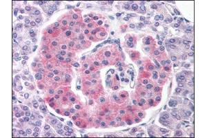 Human Pancreas (formalin-fixed, paraffin-embedded) stained with KCNJ11at 3. (KCNJ11 antibody  (Internal Region))