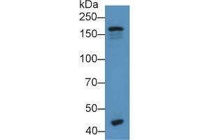 Detection of C3 Convertase in Human Serum using Monoclonal Antibody to Complement C3 Convertase (C3 Convertase) (Complement C3 Convertase antibody)