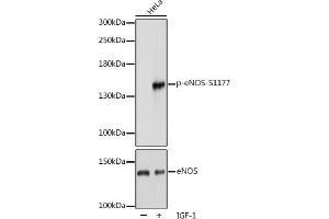 Western blot analysis of extracts of HeLa cells, using Phospho-NOS3-S1177 pAb (ABIN3020411, ABIN3020412, ABIN3020413 and ABIN1681908) at 1:1000 dilution or eNOS antibody (ABIN3022121, ABIN3022122, ABIN3022123 and ABIN6218610). (ENOS antibody  (pSer1177))