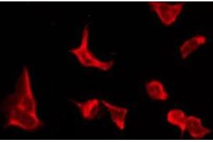 ABIN6276152 staining LOVO by IF/ICC. (OR4C16 antibody  (Internal Region))