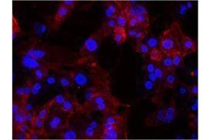 Immunofluorescence (IF) image for anti-Integrin, alpha 6 (ITGA6) antibody (ABIN2664749) (ITGA6 antibody)