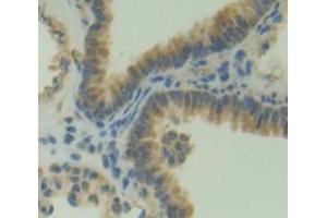 Used in DAB staining on fromalin fixed paraffin- embedded Kidney tissue (PLEKHA1 antibody  (AA 105-351))