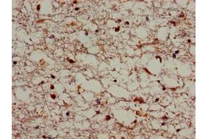 Immunohistochemistry of paraffin-embedded human brain tissue using ABIN7170339 at dilution of 1:100 (SORL1 antibody  (AA 525-744))