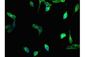 Immunofluorescent analysis of Hela cells using ABIN7175097 at dilution of 1:100 and Alexa Fluor 488-congugated AffiniPure Goat Anti-Rabbit IgG(H+L) (UNG antibody  (AA 114-224))