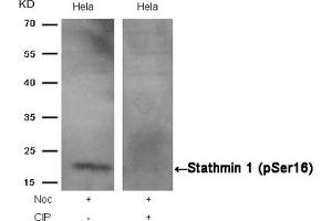 Western blot analysis of extracts from Hela cells, treated with Noc or calf intestinal phosphatase (CIP), using Stathmin 1 (Phospho-Ser16) Antibody. (Stathmin 1 antibody  (pSer16))