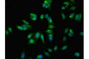 Immunofluorescent analysis of Hela cells using ABIN7153422 at dilution of 1:100 and Alexa Fluor 488-congugated AffiniPure Goat Anti-Rabbit IgG(H+L)