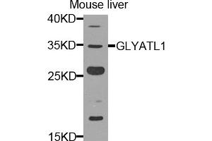 Western blot analysis of extracts of mouse liver, using GLYATL1 antibody.
