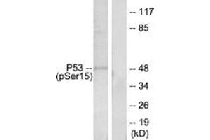 Western blot analysis of extracts from HeLa cells treated with HU, using p53 (Phospho-Ser15) Antibody.