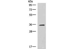 Western blot analysis of K562 cell lysate using JAM3 Polyclonal Antibody at dilution of 1:1000