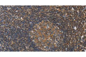 Immunohistochemistry of paraffin-embedded Human tonsil tissue using RAD54L2 Polyclonal Antibody at dilution 1:40 (ARIP4 antibody)