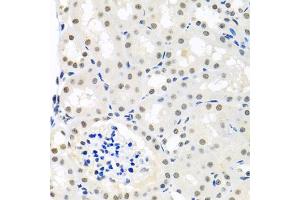Immunohistochemistry of paraffin-embedded mouse kidney using THOC1 antibody (ABIN5974800) at dilution of 1/100 (40x lens). (THOC1 antibody)