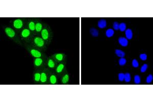 HepG2 cells were stained with HDAC8 (4C3) Monoclonal Antibody  at [1:200] incubated overnight at 4C, followed by secondary antibody incubation, DAPI staining of the nuclei and detection. (HDAC8 antibody)