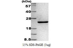 SDS-PAGE (SDS) image for Anterior Gradient Homolog 2 (Xenopus Laevis) (AGR2) (AA 21-175) protein (His tag) (ABIN667050)
