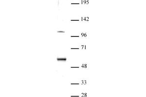 ELP3 antibody (pAb) tested by Western blot. (ELP3/KAT9 antibody  (N-Term))