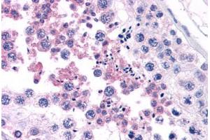 Human Testis (formalin-fixed, paraffin-embedded) stained with CAMP antibody ABIN343893 at 5 ug/ml followed by biotinylated goat anti-rabbit IgG secondary antibody ABIN481713, alkaline phosphatase-streptavidin and chromogen. (Cathelicidin antibody  (C-Term))