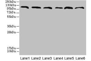Western blot All lanes: CATSPERE antibody at 6 μg/mL Lane 1: U87 whole cell lysate Lane 2: HepG2 whole cell lysate Lane 3: A549 whole cell lysate Lane 4: Mouse lung tissue Lane 5: Mouse liver tissue Lane 6: PC-3 whole cell lysate Secondary Goat polyclonal to rabbit IgG at 1/10000 dilution Predicted band size: 110, 96, 93 kDa Observed band size: 110 kDa (Cation Channel Sperm-Associated Protein Subunit epsilon (CATSPERE) (AA 601-832) antibody)