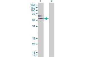 Western Blot analysis of PDE9A expression in transfected 293T cell line by PDE9A MaxPab polyclonal antibody. (PDE9A antibody  (AA 1-533))