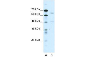ACCN1 antibody used at 2 ug/ml to detect target protein. (ACCN1 antibody)
