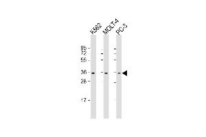 Western Blot at 1:1000 dilution Lane 1: K562 whole cell lysate Lane 2: MOLT-4 whole cell lysate Lane 3: PC-3 whole cell lysate Lysates/proteins at 20 ug per lane. (PIGC antibody  (AA 264-294))